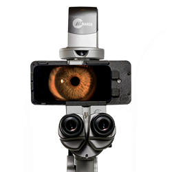 Marco iON Slit Lamp Imaging System 