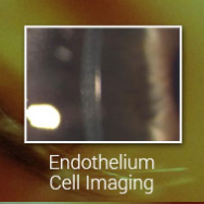 Endothelium Imaging Solutions