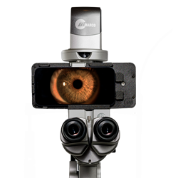 Marco iON Slit Lamp Imaging System 