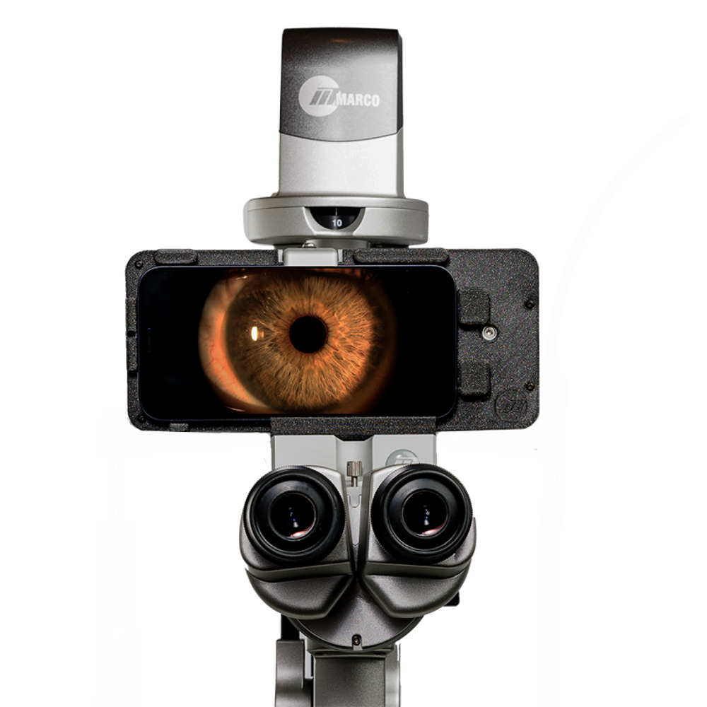Marco Instruments Ophthalmic Equipment | Marco iON Slit Lamp Imaging System | Veatch ...