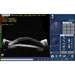 4Sight Ultrasound Platform - USKE04-00